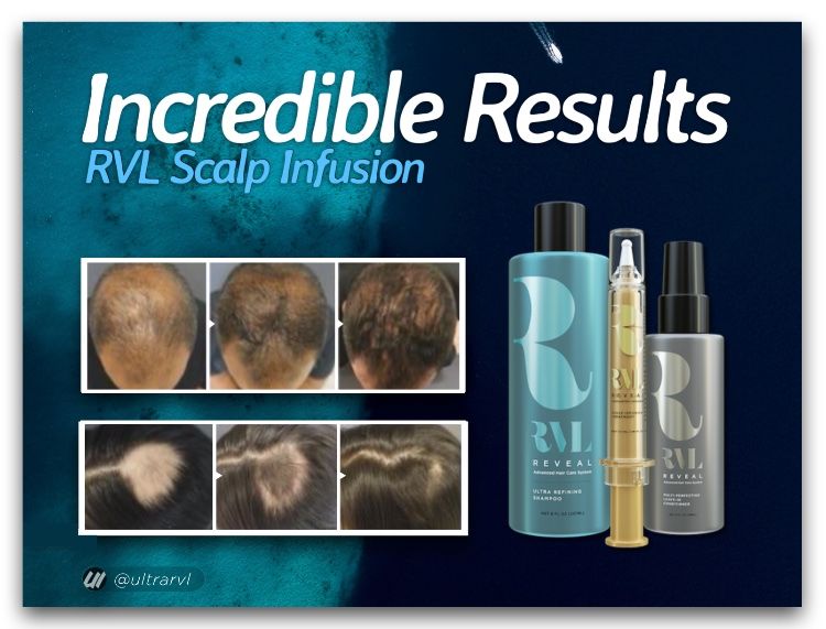 Результаты применения RVL шампуни, кондеционера и сыворотки для восстановления волос. Picture.