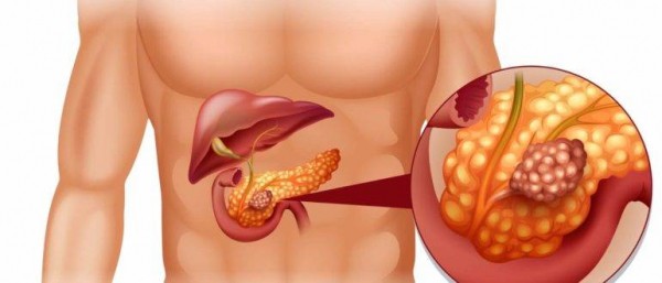 Рейтинг 10 лучших лекарств для поджелудочной железы: боремся с панкреатитом