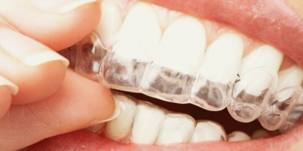Рейтинг лучших стоматологических кап для отбеливания зубов в 2024 году