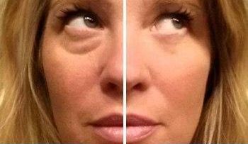 photo_#InstantlyAgelesse, до и после применения, лицо женщины.